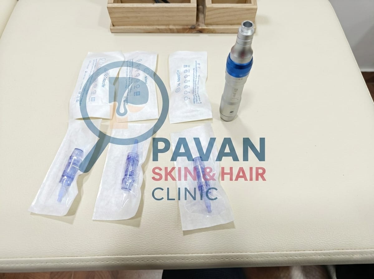 Microneedling